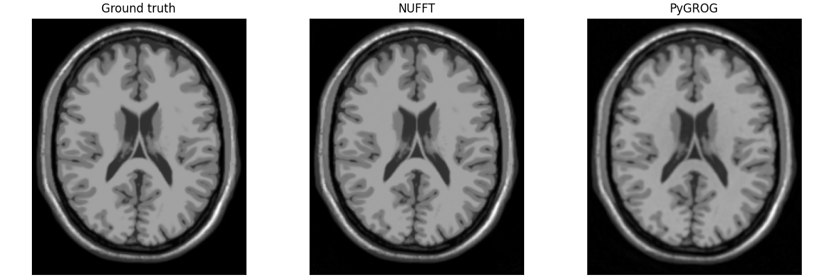 Ground truth, NUFFT, PyGROG