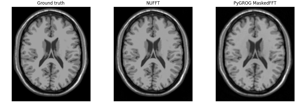 Ground truth, NUFFT, PyGROG MaskedFFT