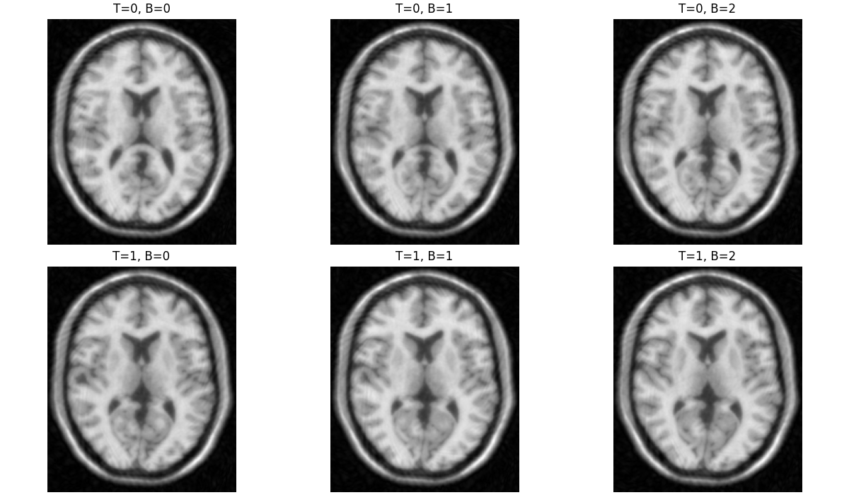 T=0, B=0, T=0, B=1, T=0, B=2, T=1, B=0, T=1, B=1, T=1, B=2