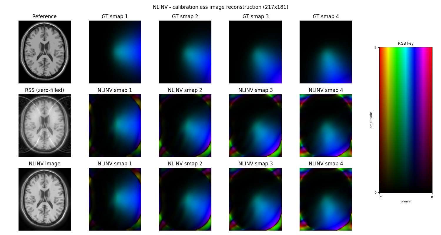 NLINV - calibrationless image reconstruction (217x181), Reference, GT smap 1, GT smap 2, GT smap 3, GT smap 4, RSS (zero-filled), NLINV smap 1, NLINV smap 2, NLINV smap 3, NLINV smap 4, NLINV image, NLINV smap 1, NLINV smap 2, NLINV smap 3, NLINV smap 4, RGB key
