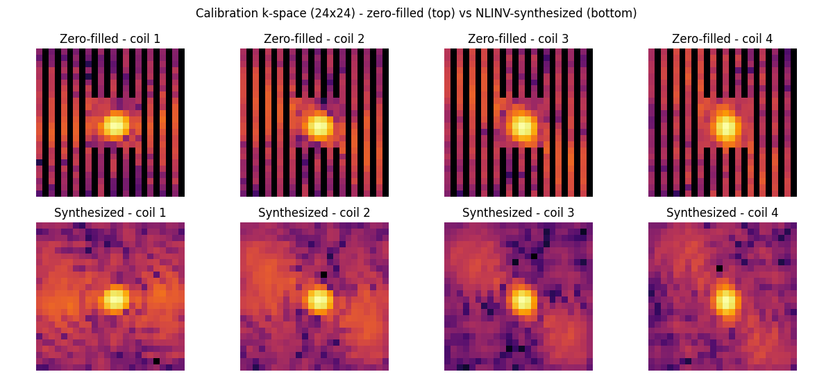 Calibration k-space (24x24) - zero-filled (top) vs NLINV-synthesized (bottom), Zero-filled - coil 1, Zero-filled - coil 2, Zero-filled - coil 3, Zero-filled - coil 4, Synthesized - coil 1, Synthesized - coil 2, Synthesized - coil 3, Synthesized - coil 4
