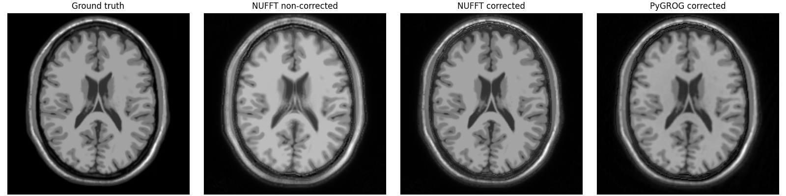 Ground truth, NUFFT non-corrected, NUFFT corrected, PyGROG corrected