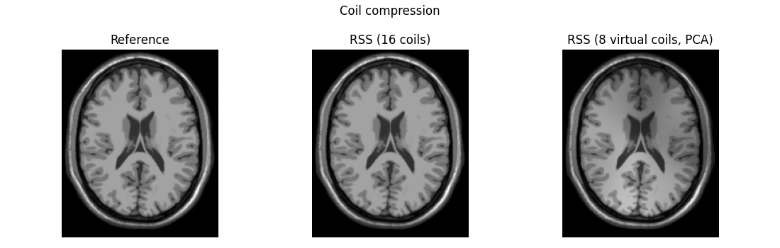 Coil compression, Reference, RSS (16 coils), RSS (8 virtual coils, PCA)